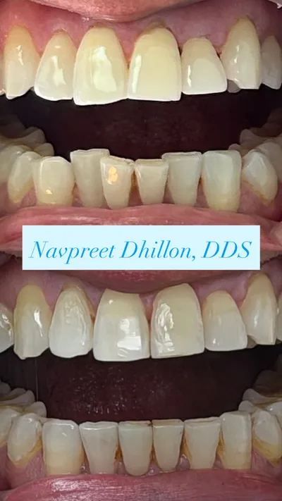 Before and after dental treatment from Nelson Dental Practice's smile gallery